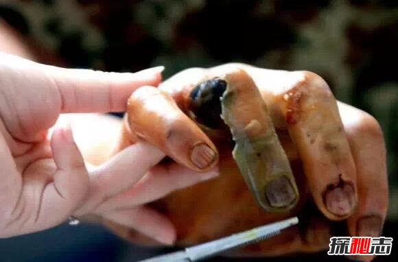 原矛头蝮龟壳花蛇,0.12毫克毒液让人溃烂致死