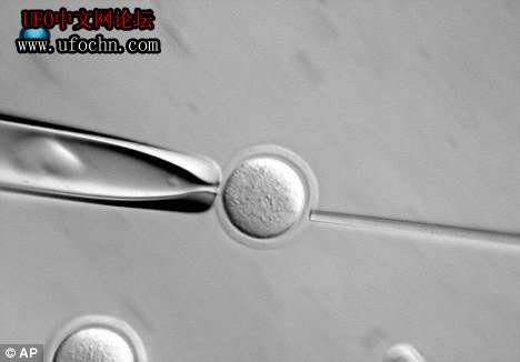 美研究称大脑回路可修复 帕金森病等治愈有望427 / 作者:伤我心太深 / 帖子ID:9075