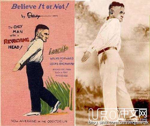 20世纪畸形秀中的怪人头部可以旋转180度的男子219 / 作者:伤我心太深 / 帖子ID:18273