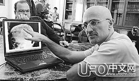 世界首例人体换头术797 / 作者:骑UFO看外星人 / 帖子ID:19836