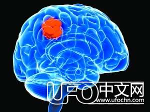 人类大脑利用率10%并不可信208 / 作者:伤我心太深 / 帖子ID:19977