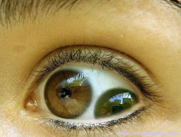双瞳孔的人能看到鬼吗,双瞳孔图片解密755 / 作者:揭秘者 / 帖子ID:25777