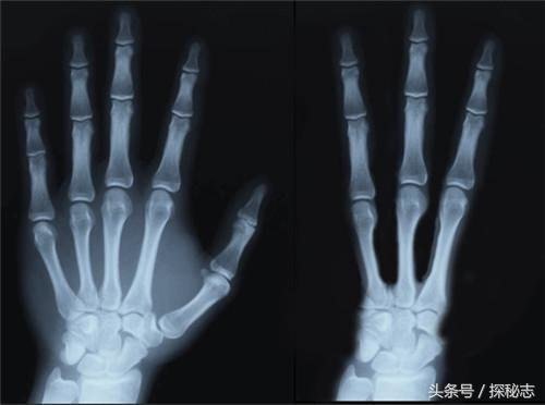 刚出土的千年干尸只有3手指3脚趾，难道真是外星文明？584 / 作者:静风 / 帖子ID:27879