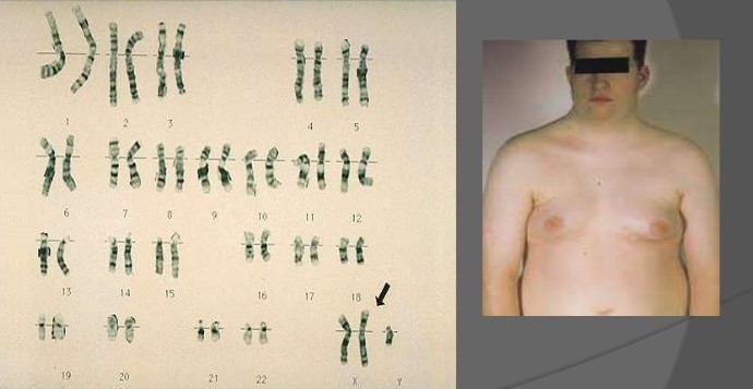 神秘丢失的两条染色体能否揭示人类的起源？313 / 作者:IANqGpQc / 帖子ID:31382