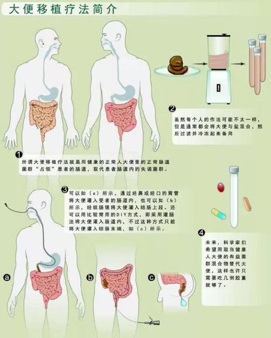 吃屎居然能治病！ 吃屎去吧，是骂人的话吗380 / 作者:UFO外星人爱好者 / 帖子ID:32189