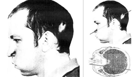地球上唯一被粒子加速器“爆过头”还活着的人912 / 作者:UFO外星人爱好者 / 帖子ID:32747