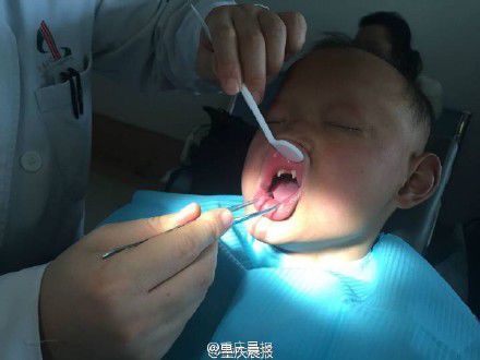 男孩患怪病酷似”吸血鬼“ 长有獠牙且畏光720 / 作者:UFO外星人爱好者 / 帖子ID:33422