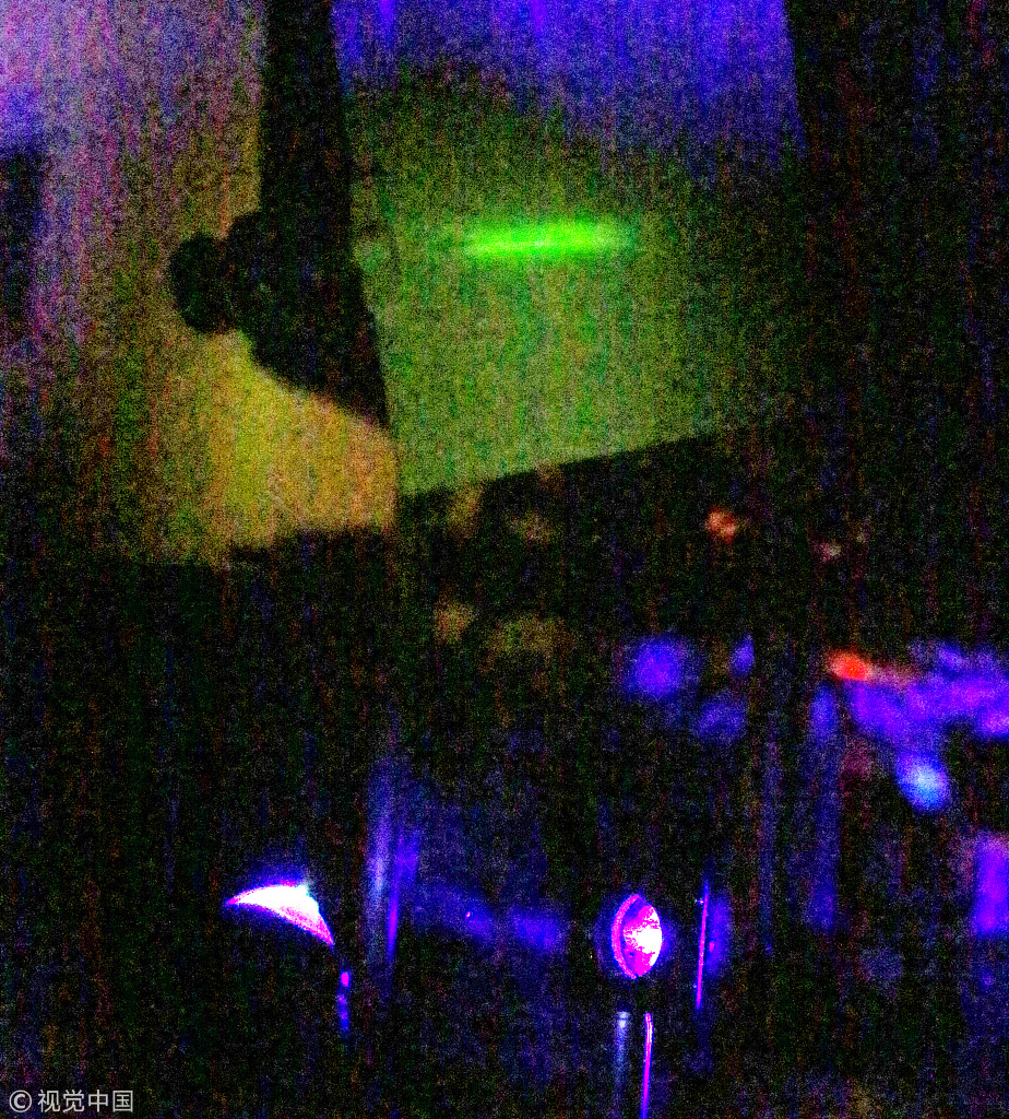 居然有发出激光的隐形眼镜，不可思议！562 / 作者:UFO外星人爱好者 / 帖子ID:33740