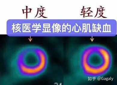 如何评价人类的第一张黑洞照片？234 / 作者:ylzhang / 帖子ID:45481