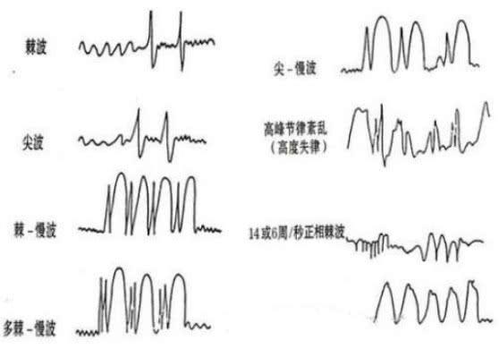人类灵魂或由超弦组成，它可以独立于肉体存在926 / 作者:redfree / 帖子ID:46875
