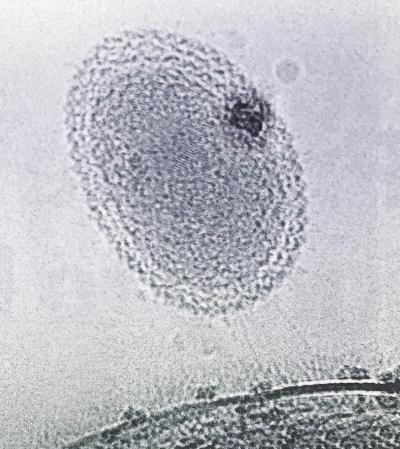 科学家发现改写人类生命的微生物“暗物质”，未来将产生深远影响917 / 作者:静静的读你 / 帖子ID:47494