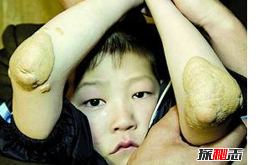 最恐怖的40种怪病,英国8岁少女患睡美人症442 / 作者:伤我心太深 / 帖子ID:47957