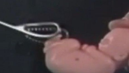 告诉你堕胎的真相,堕胎时胎儿是如何被杀死的,430 / 作者:UFO外星人爱好者 / 帖子ID:48085