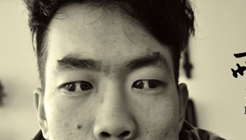 什么是双瞳孔-世界上有双瞳孔的人吗-943 / 作者:爱英语的人 / 帖子ID:48444