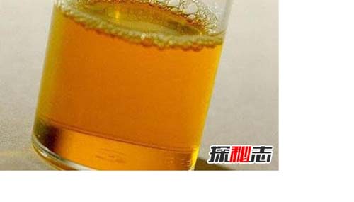 低智商的九种表现是什么？483 / 作者:爱英语的人 / 帖子ID:48487