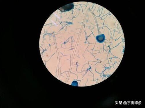 最大辐射剂量可达人类的200倍，第一个星际物种原来就在我们身边267 / 作者:常务管理员 / 帖子ID:48583
