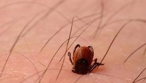 世界十大吸血鬼生物，吸血鲶鱼通过尿道钻入人体558 / 作者:网上的人生 / 帖子ID:48893