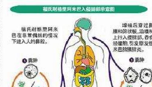 福氏耐格里变形虫,到底有什么可怕的441 / 作者:小深 / 帖子ID:49090