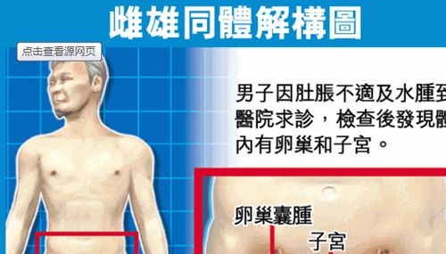 雌雄难辨的两性人，拥有两套生殖器官305 / 作者:网上的人生 / 帖子ID:48841