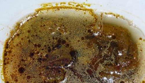 神奇的异鳞蛇鲭，进食后导致胃部痉挛肛门流油226 / 作者:小深 / 帖子ID:49046