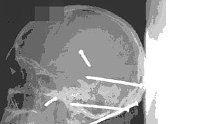 世界上有长生不死的人吗-亚马逊森林死不了的人奥鲁·乌加欧837 / 作者:网上的人生 / 帖子ID:49303