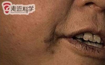 中国辽宁吃煤的女人，34年吃掉5000公斤的煤229 / 作者:网上的人生 / 帖子ID:49140