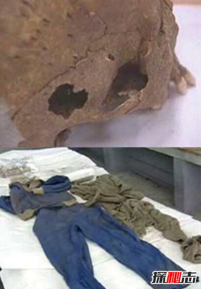 揭秘青蛙少年失踪案真相233 / 作者:志向探秘 / 帖子ID:49700