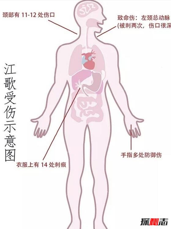 陈世峰下跪向江母磕头，检方称顶多被判20年325 / 作者:网上的人生 / 帖子ID:49581