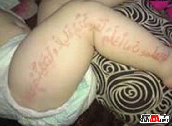 俄罗斯婴儿腿上皮肤能显示古兰经经文，胎记惊现经文_真主显灵424 / 作者:网上的人生 / 帖子ID:49558