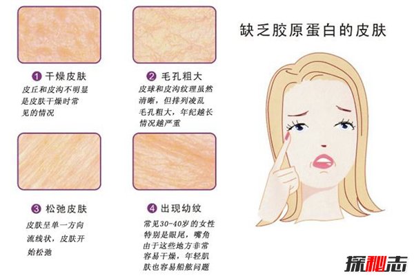 长期喝胶原蛋白的危害 这三大危害影响身体971 / 作者:网上的人生 / 帖子ID:51567