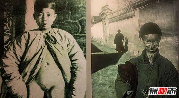 世界十大恐怖习俗 第一相当畸形第八世界常见567 / 作者:网上的人生 / 帖子ID:51560