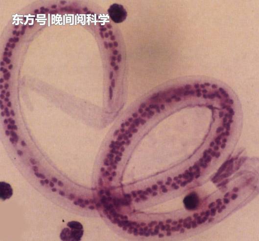 科学家在海底发现海洋“高音”，身长29毫米，声音却比鲸鱼还强691 / 作者:yiyee123 / 帖子ID:52522