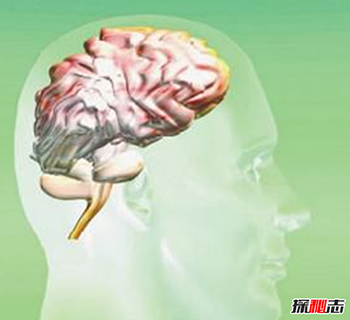 有史以来最小脑部是多小-谁的脑袋891 / 作者:网上的人生 / 帖子ID:52966