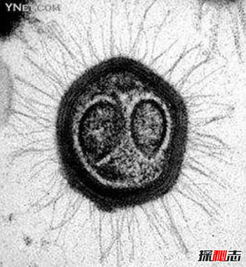 世界上最大的病毒：米米病毒（Mimicking microbe virus）812 / 作者:揭秘者 / 帖子ID:56207