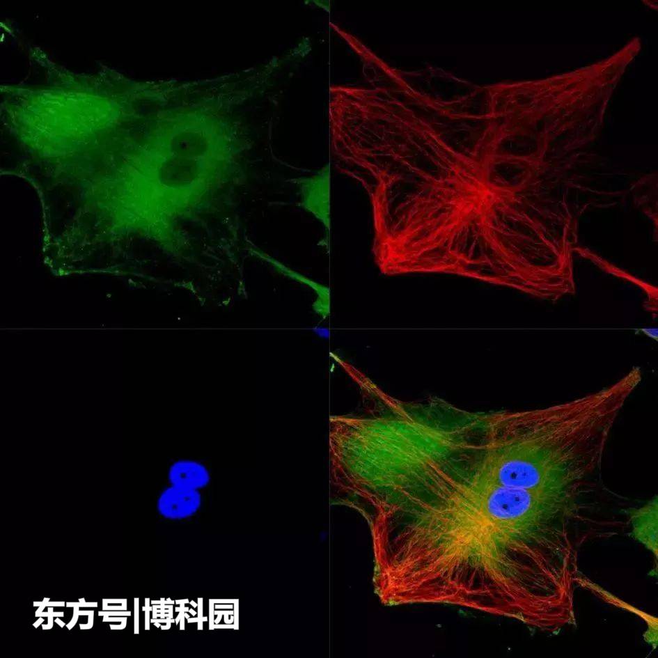 打破阿贝衍射极限，超分辨率显微镜毫秒级成像，看百万分之一毫米569 / 作者:sosoyoyo / 帖子ID:54127