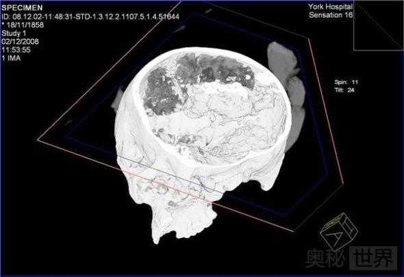 英格兰发现2500年前保存完好的大脑758 / 作者:UFO外星人爱好者 / 帖子ID:60127