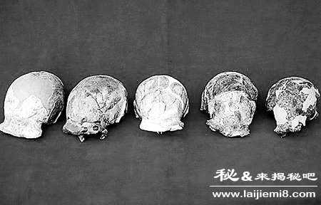 北京猿人头盖骨化石消失下落之谜793 / 作者:UFO来啦 / 帖子ID:62379 北京猿人头盖骨化石消失下落之谜793 / 作者:UFO来啦 / 帖子ID:62379