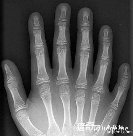 神秘六指外星人：3米高蓝眼睛大牙齿753 / 作者:UFO外星人爱好者 / 帖子ID:57564