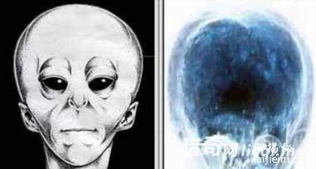 奇异头骨：外星人曾与人类交配铁证！974 / 作者:UFO来啦 / 帖子ID:60945