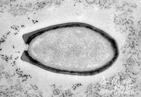尼安德特人病毒:某些癌症患者发现匹配DNA512 / 作者:UFO来啦 / 帖子ID:63602 尼安德特人病毒:某些癌症患者发现匹配DNA512 / 作者:UFO来啦 / 帖子ID:63602
