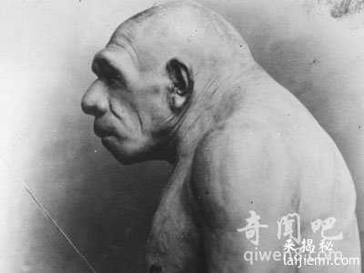 尼安德特人病毒:某些癌症患者发现匹配DNA673 / 作者:UFO来啦 / 帖子ID:63602 尼安德特人病毒:某些癌症患者发现匹配DNA673 / 作者:UFO来啦 / 帖子ID:63602