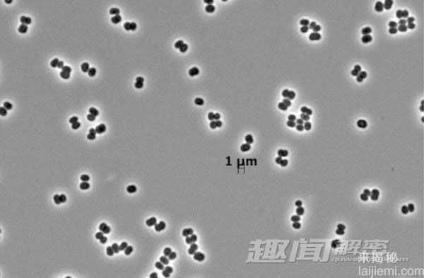 揭秘：2014年自然界新发现十大物种排行458 / 作者:UFO来啦 / 帖子ID:64021