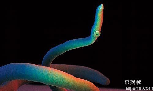 可怕！盘点最常见的十大人体寄生虫567 / 作者:UFO来啦 / 帖子ID:62723