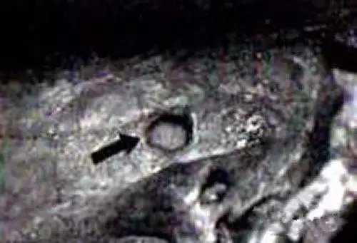 俄罗斯科学家发现, 万年前头骨出现子弹孔-718 / 作者:UFO来啦 / 帖子ID:62171