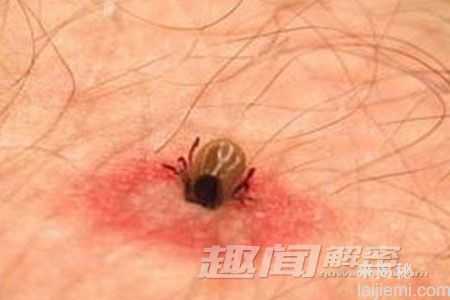 盘点:全球十大最恐怖的嗜血动物793 / 作者:UFO来啦 / 帖子ID:65217 盘点:全球十大最恐怖的嗜血动物793 / 作者:UFO来啦 / 帖子ID:65217