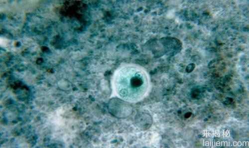 可怕！盘点最常见的十大人体寄生虫534 / 作者:UFO来啦 / 帖子ID:62723