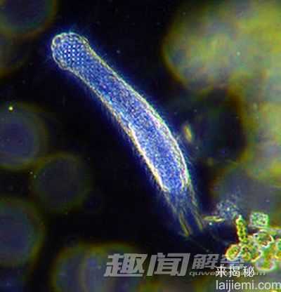 揭秘世界上13种最怪异的虫子898 / 作者:UFO来啦 / 帖子ID:63942