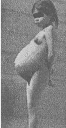 一个未解之谜：女孩5岁生下孩子168 / 作者:UFO来啦 / 帖子ID:61358