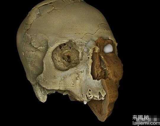 9500年前畸形头骨 复原考古学家看呆了89 / 作者:UFO来啦 / 帖子ID:61285