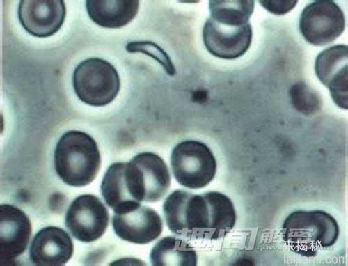 揭秘：弓形虫会影响人对猫的喜爱程度213 / 作者:UFO来啦 / 帖子ID:64040